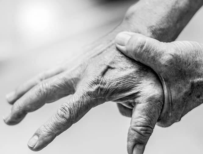 arthrose vorbeugen schmerzen handgelenk